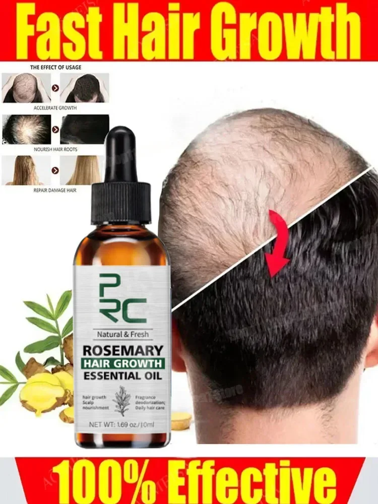 Produk penumbuh rambut Biotin Anti rambut rontok semprot kulit kepala perawatan rambut minyak esensial tumbuh cepat