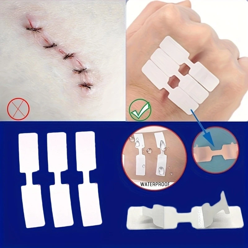 5Pcs Outdoor Wound Adhesive Tape Disposable First Aid Wound Suture Patch Wound Band Aid