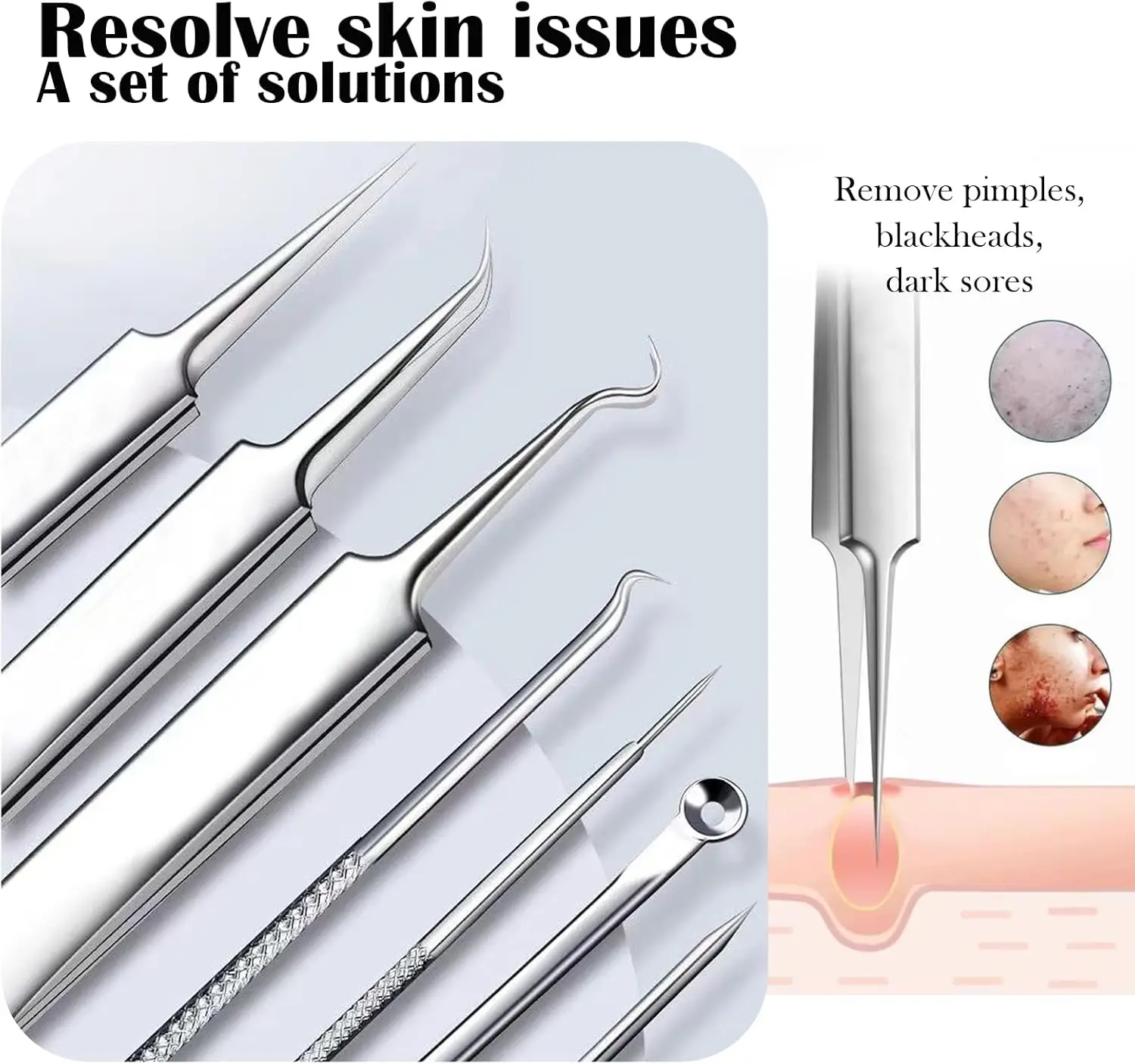 プロ仕様の8ピースステンレス製黒ずみ除去キット、精密ピンセット、白ニキビ、ニキビに優しい。