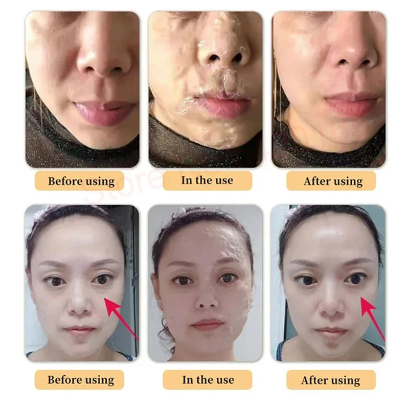 3D Hifu Hanacure Mask Facial Nude LineTherapy V Face Facial Lift Anti-aging Reducing Pores Fade Fine Line Korean Cosmetics