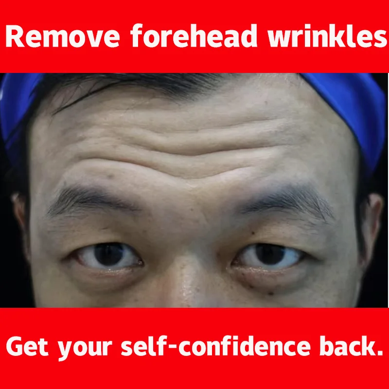 

wrinkles remover facial lifting General essence for ladies and men