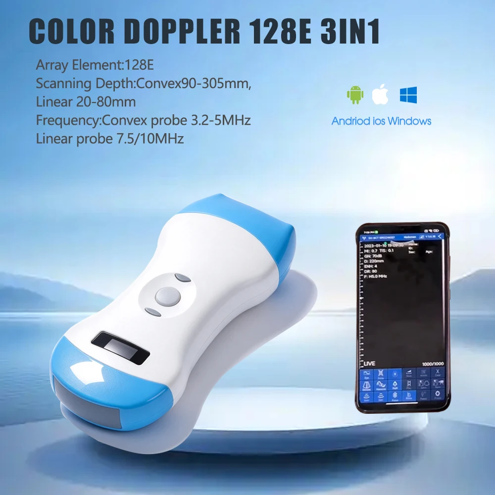Handheld-operated Wireless Ultrasound Probe, WiFi Wireless Link, Control Image Freeze And Parameter Adjustment for pet checking
