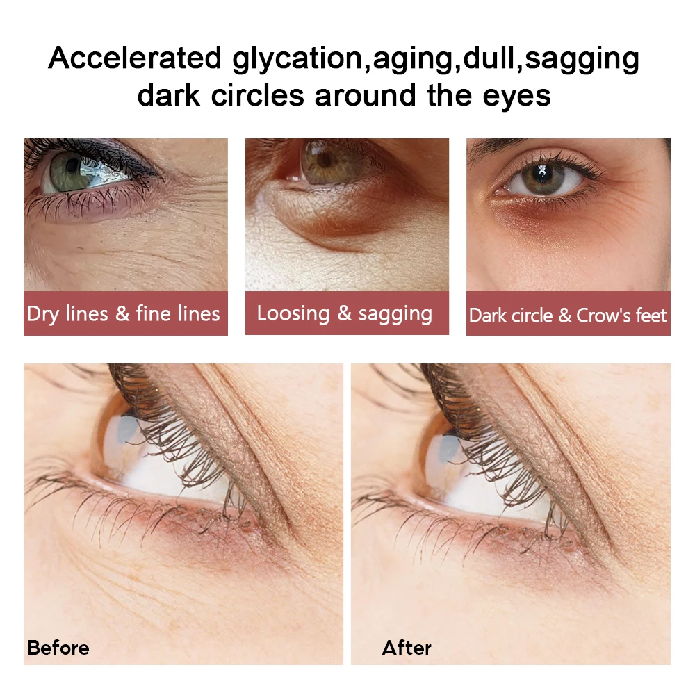 2PCS 20g Peptide Collagen Eye Cream Anti-Wrinkle Anti-Aging Remove Dark Circles Against Eye Skin Care make up eye cream