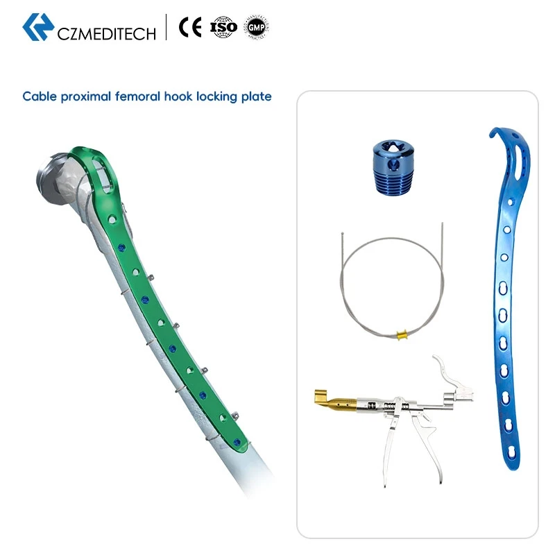 Customized OrthopeTrauma Titanium Implants Proximal Femoral Hook Locking Plate With Cable