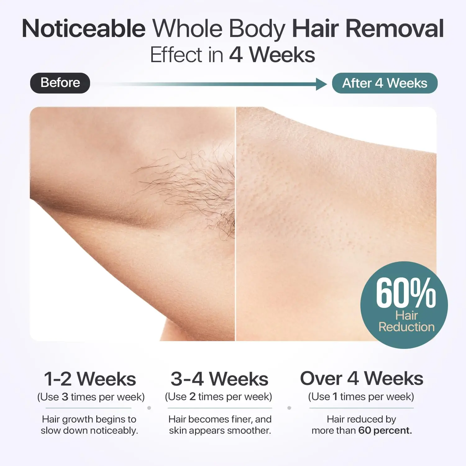 إزالة الشعر بالليزر IPL مع 40 ° F Cooling، 5 أوضاع، شاشة LCD للوجه والجسم الخالية من الألم - للرجال والنساء #6