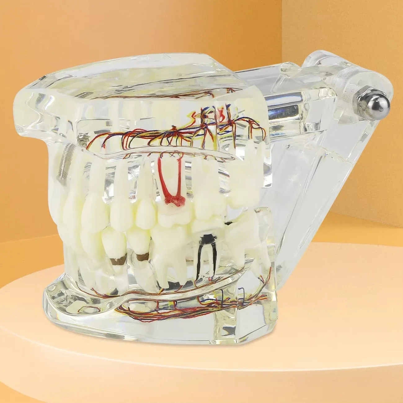 Dentals Implants Restoration Bridge Teaching Research Medical Diseases Dentals Model