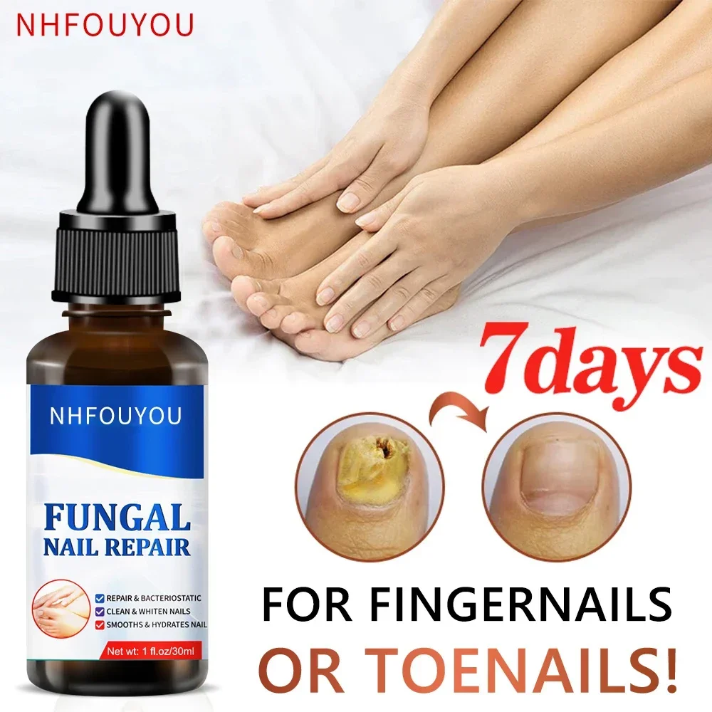 Fungal Nail Treatment Oil Foot Repair Essence Toe Nail Fungus Removal Gel Anti Infection Cream Fungal Nail Removal 10ML