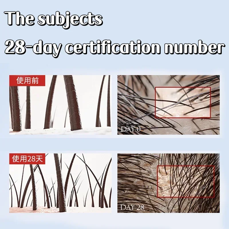 Activate Hair Follicles for Rapid Hair Growth