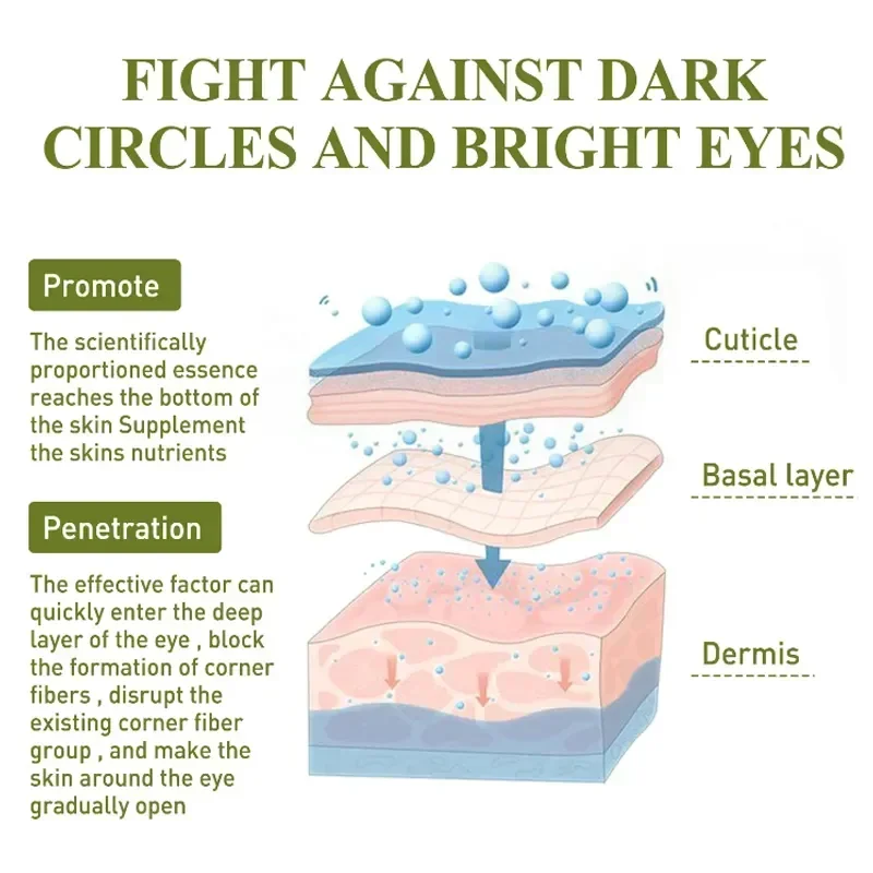 Crème anti-déformante pour les yeux, anti-taches, poches de vache foncées, décoloration des yeux, ligne fine, blanchissant, raffermissant, hydratant en profondeur, 7 jours