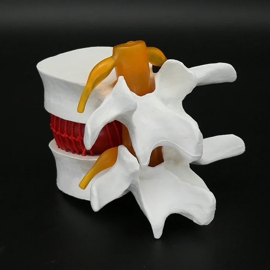 1Piece PVC Hand-Made Lumbar Vertebrae Model Auxiliary Teaching And Demonstration Tool
