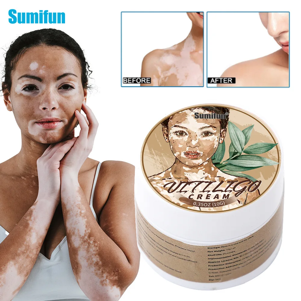 

Мазь от витилиго, мазь от белых пятен, мазь для здоровья кожи K20062