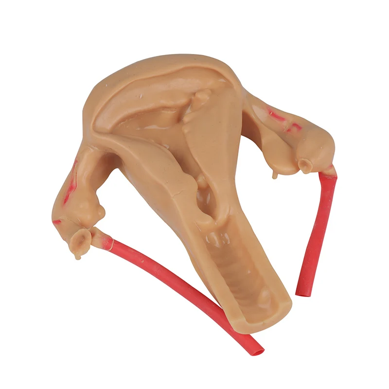 3D Biomimetic Module for Gynecological Laparoscopic Shearing Suture Stripping Exercise Simulated Uterine Silicone Model