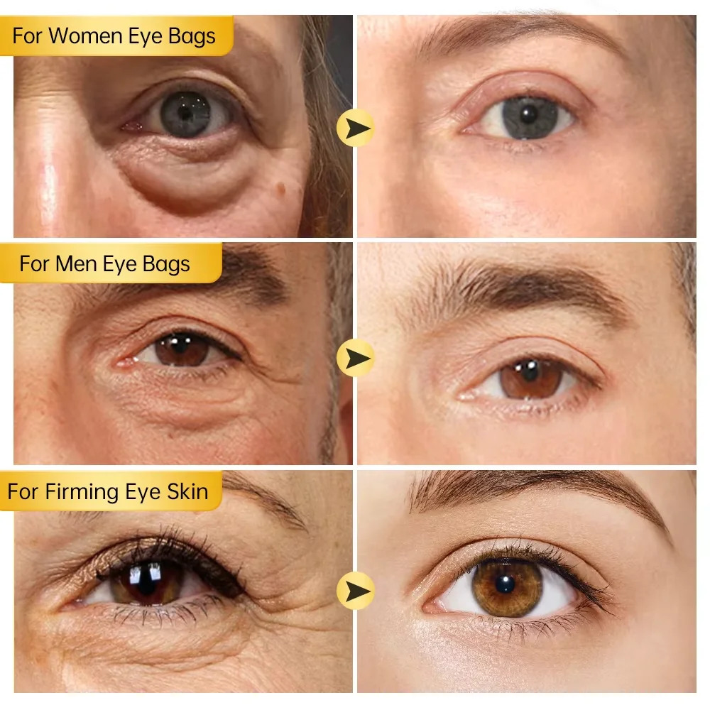 Retinol Anti Wrinkle Eye Cream Removal Eye Bag Anti Dark Circles Fade Fine Lines Firming Skin Anti Puffiness Brighten Eye Care