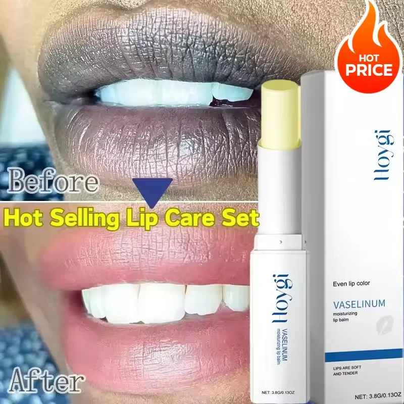 

Remove Dark Smoke Lip Balm Lightening Melanin Bleaching Gloss Oil Lips Pink Lipstick Exfoliating Fade Lip Lines Korean Cosmetics