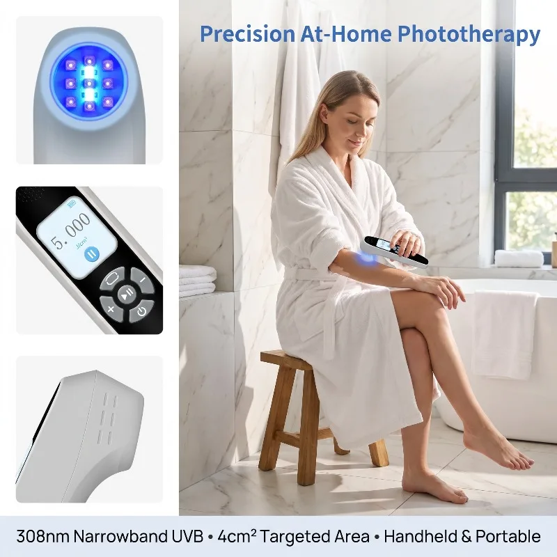 Toponechoice 308nm UVB Light Therapy Device 9 Diodes Uvb Phototherapy Device Narrow Band Home Unit Laser Led for Lichen Planus