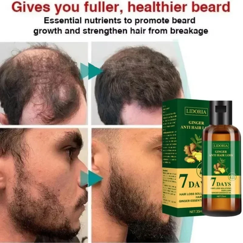 Thumbnail 3 - #27 Compare Hair Loss Treatments Before You Buy