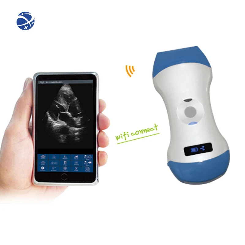 

3 in 1 Wireless Cardiac Ultrasound Scanner Machine Convex / Linear / Phased Array Probe with Higher Definition Imaging