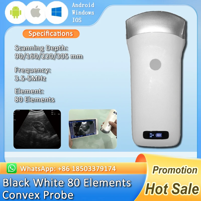 Wireless Portable Ultrasound Probe scanner WIFI Doppler wifi ultrasound scanner Machine support iOS Android Windows