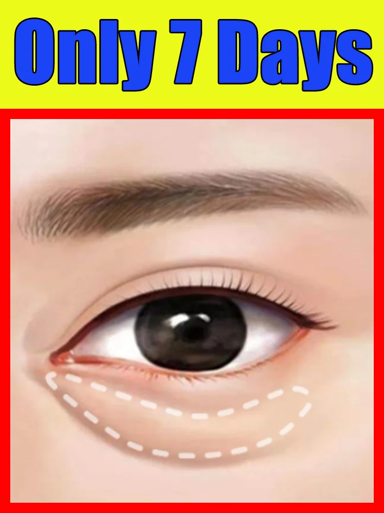

2026 Hot Care Tools Eye Vitality Ointment Free shipping unisex HOT