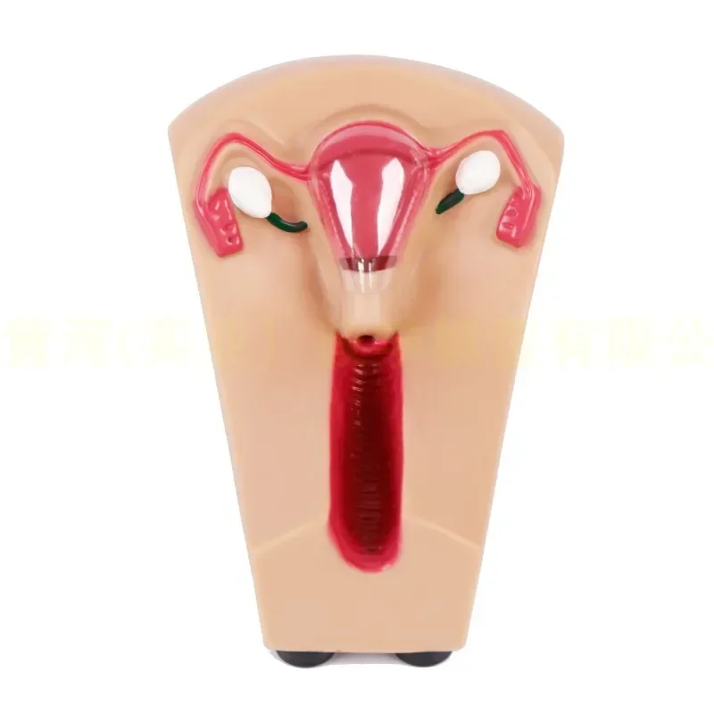 YX/B3 Female Intrauterine Contraceptive Device and Training Model - Uterine Genital Organ Teaching Mold - IUD Removal