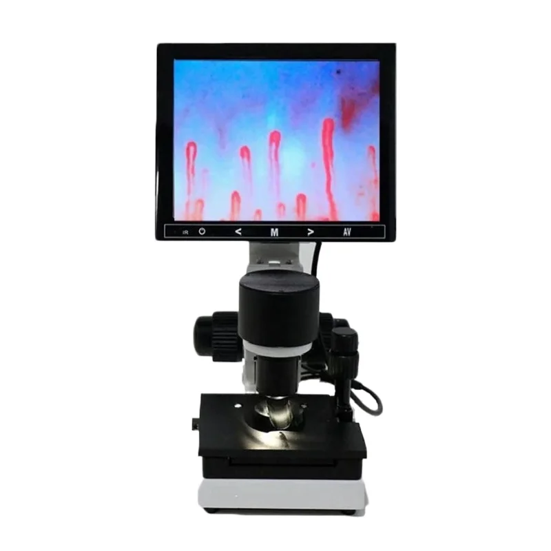 AAAA Microscope Zoom Nailfold Capillary Microcirculation Detector Blood Microcirculation Analyzer with 7/8/9