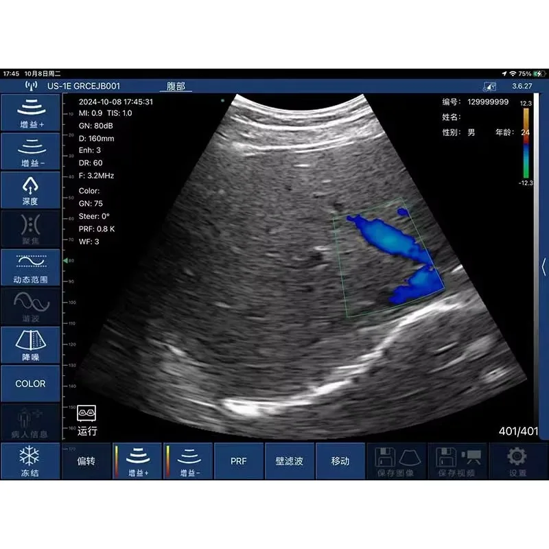 3CL Palm-Sized Wireless Color Ultrasound Scanner – Mini Handheld Ultrasound