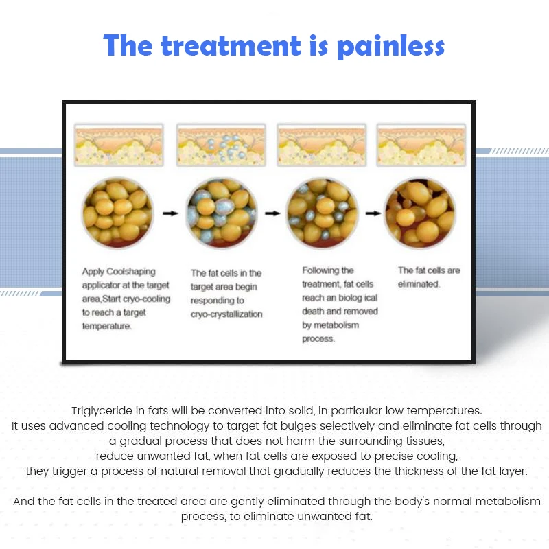 Cryoskin Thermal & T Shock System Machine amincissante, Sculptant le corps, Congélation des graisses, Perte de poids