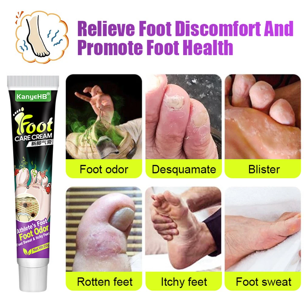 Foot Beriberi Treatment Cream Remove Foot Odor Tinea Pedis Cream Anti-Itch Inhibits Fungus Pedicure Prevent Foot Peeling Care