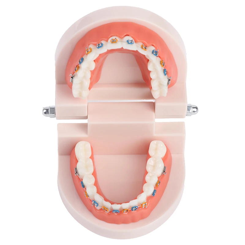 1 шт. Стоматологическая Ортодонтическая модель зубов с металлическими скобами