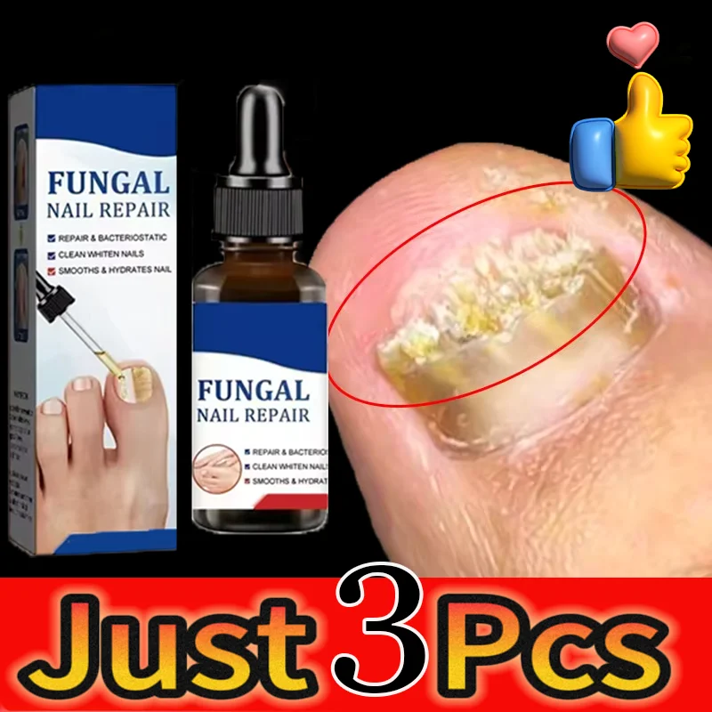 

Fungal Nail Laser Treatment Device Repair Toenail Anti Infection Paronychia Onychomycosis Ingrown Toenail Foot Care Essence