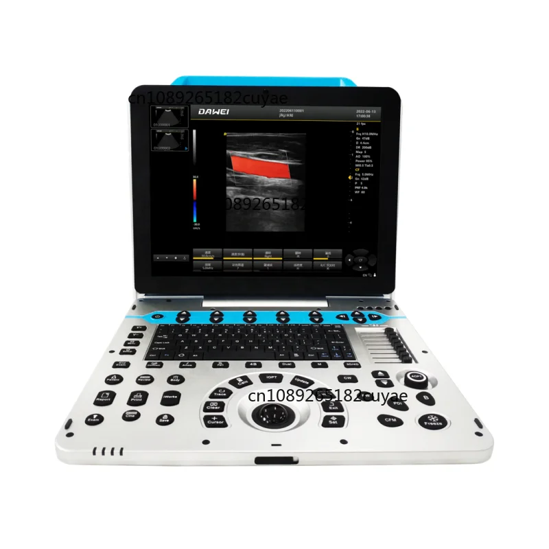 Vet Instrument Dawei Vet Ultrasound Scanner Veterinary Digital Ultrasound Machine Companion Animal Color Doppler Ultrasound