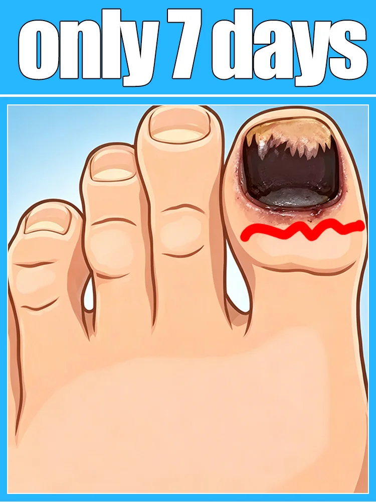 

Новая улучшенная версия 2025 года: пластиковые инструменты для педикюра и чистки ног - 2-е поколение