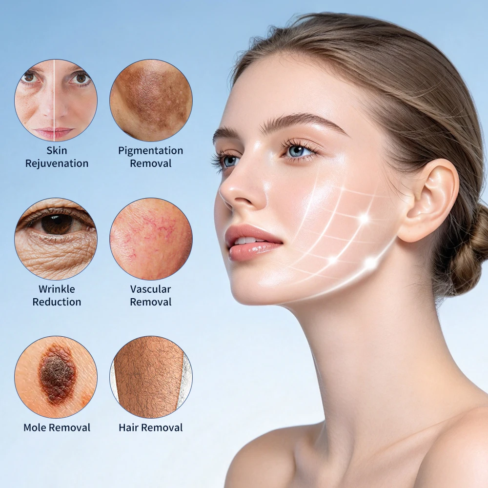 5 IN 1 Permanent Hair Removal Machine Face Freckle Mole Removal Multifunctional Beauty Device Electrolysis Hair Removal