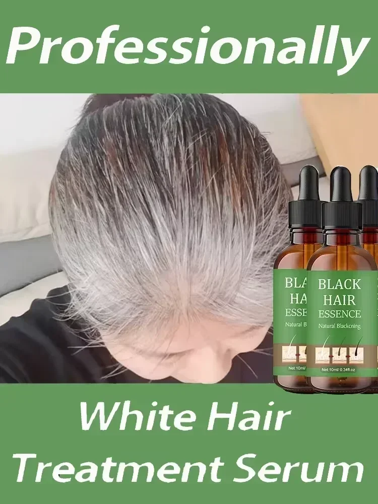 White hair killer, remove gray hair and restore natural hair color in 7 days Healthy,quickly turns white airh into black