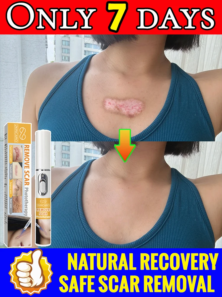 

Это секрет к безупречной коже