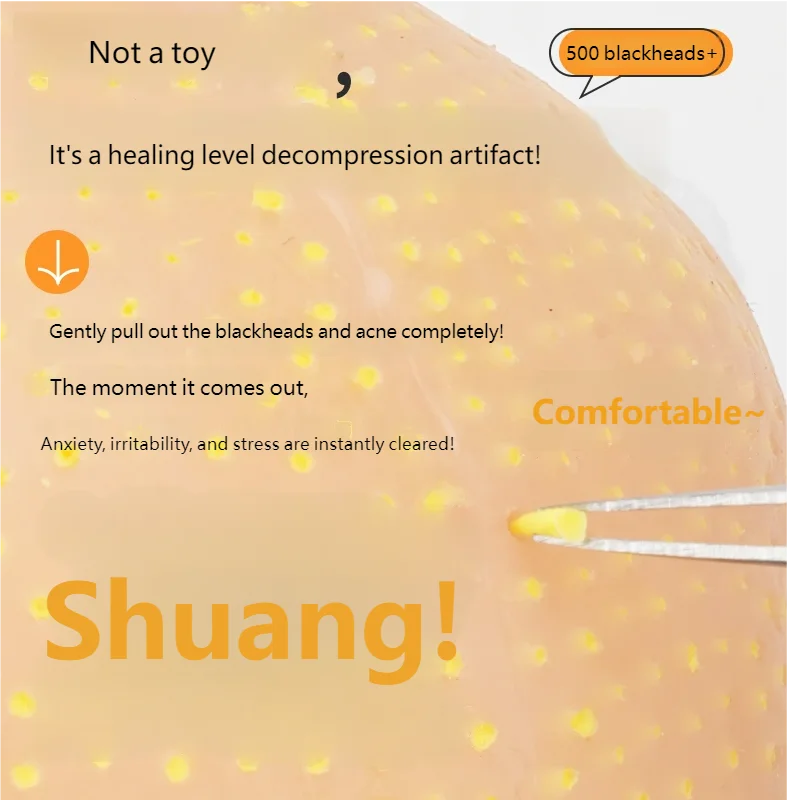Realistic Pimple Popper Fidget Toy Silicone Sensory Stress Reliever For Anxiety Simulation Blackhead SqueezingToy Model Reusable