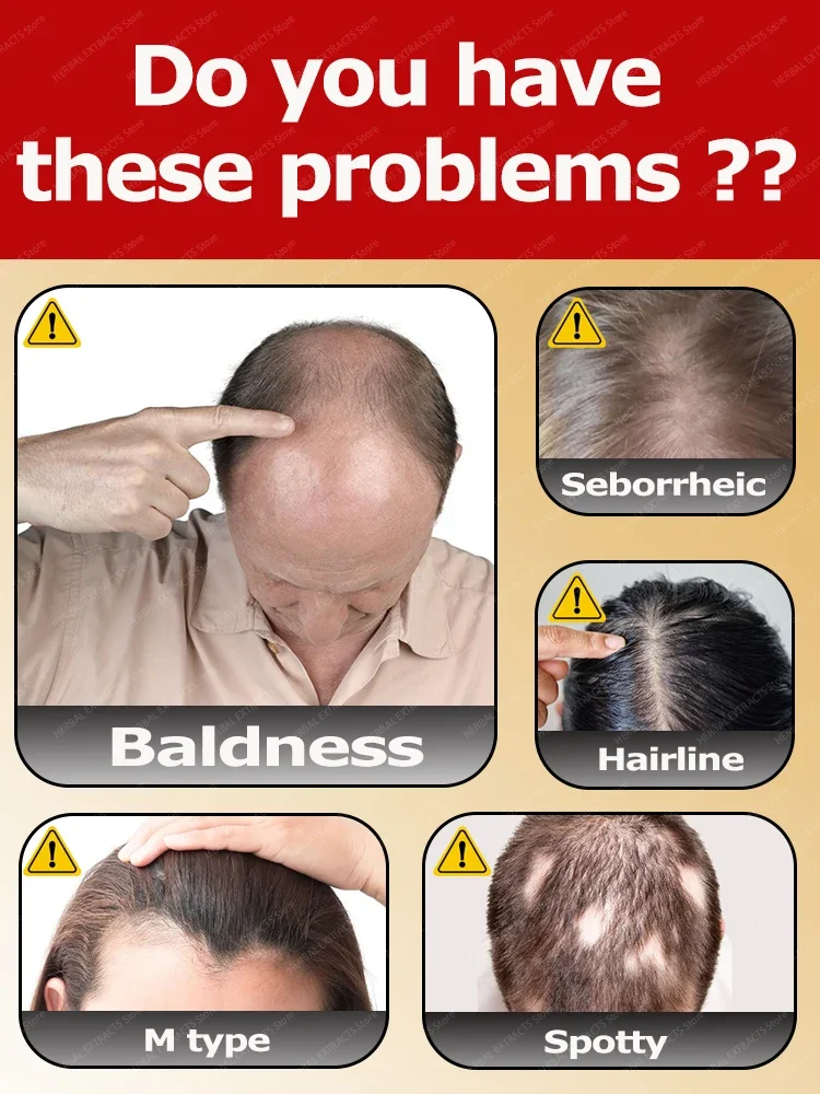 

Hot sale, more hair. Say goodbye to baldness, the secret to thick hair,Grow hair anywhere.