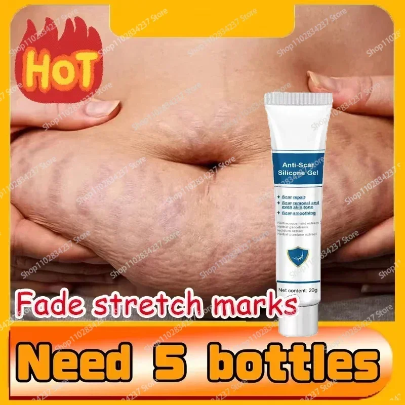 

Eliminate Red White Old Stretch Marks Cream For Pregnancy Postpartum Skin Care Gel 8