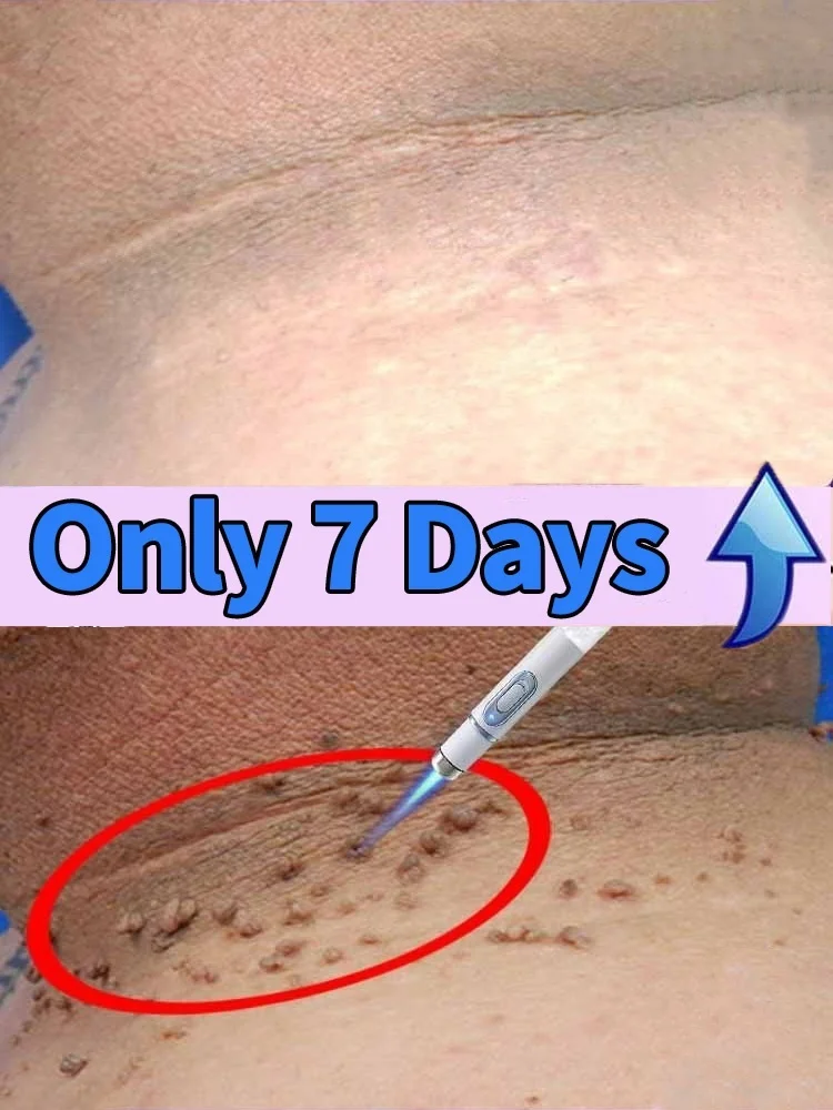 

moisturize skin for all people
