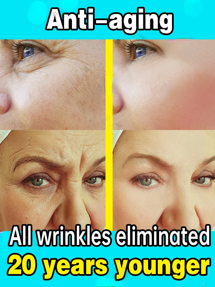 2023 New Upgrade Wrinkle Removal Serum Anti-aging Fade Fine Line Firm Lift Whitening Freckle Sensitive Skin Repair For Women Men