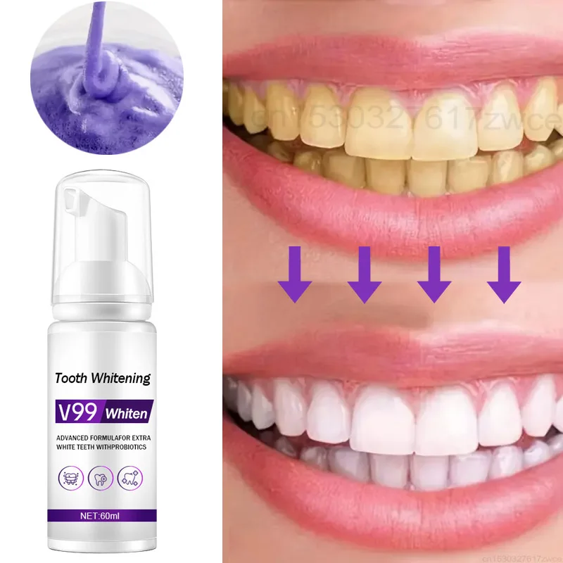 Creme dental branqueador roxo V99 Mousse de limpeza de dentes, remover manchas, reduzir amarelamento, cuidar das gomas de dentes, respiração fresca, 2023