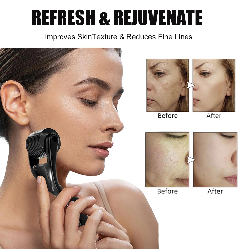 เดอร์มา โรลเลอร์สำหรับใบหน้าร่างกายผมเคราการเจริญเติบโต 540 ลูกกลิ้งต่อต้านริ้วรอยฟื้นฟูผิวใบหน้าลูกกลิ้งเครื่องมือดูแลผิวสำหรับผู้ชายผู้หญิง