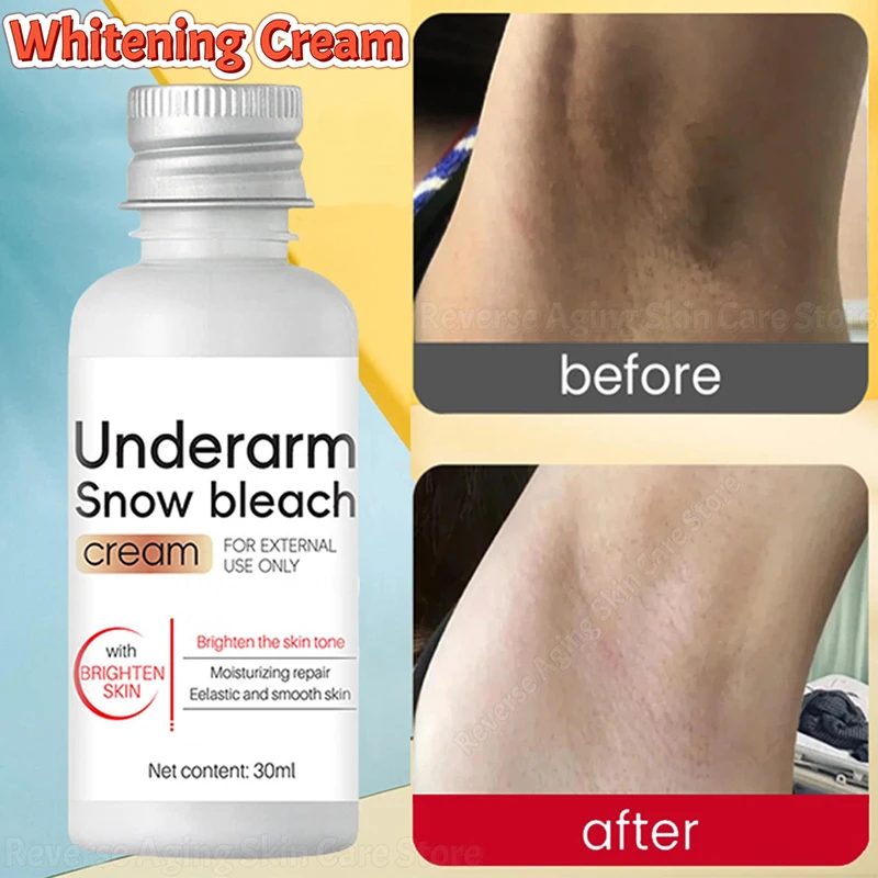 Body Whitening Bleach Cream Brighten Underarm Elbow Knees Joint Removal Intimate Parts Dark Spots Melanin Snow Bleach Cream 30ml