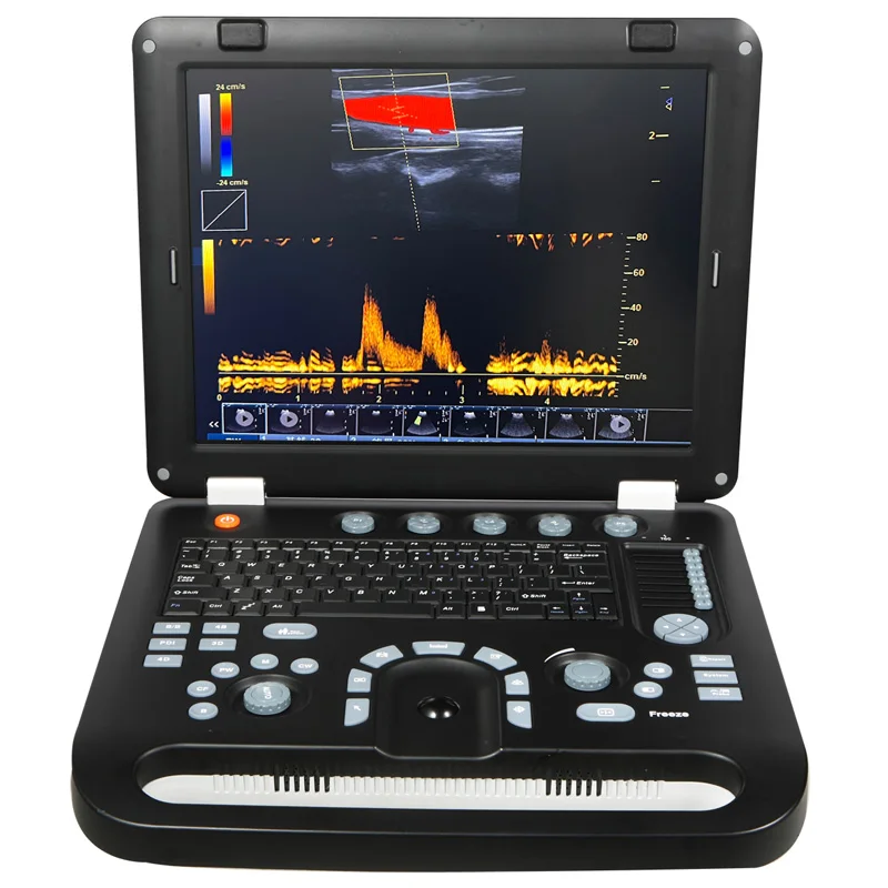 Wh-29  Portable Medical 4D Doppler Ultrasound Instruments 15 Inches Pocket Laptop Ultrasound Machine for sale