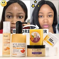 Kit de soins pour la peau au curcuma biologique, éclaircissant, propre, élimine les ténèbres, les taches, l'acné, éclaircit, hydratation, exfolier, même le teint 1