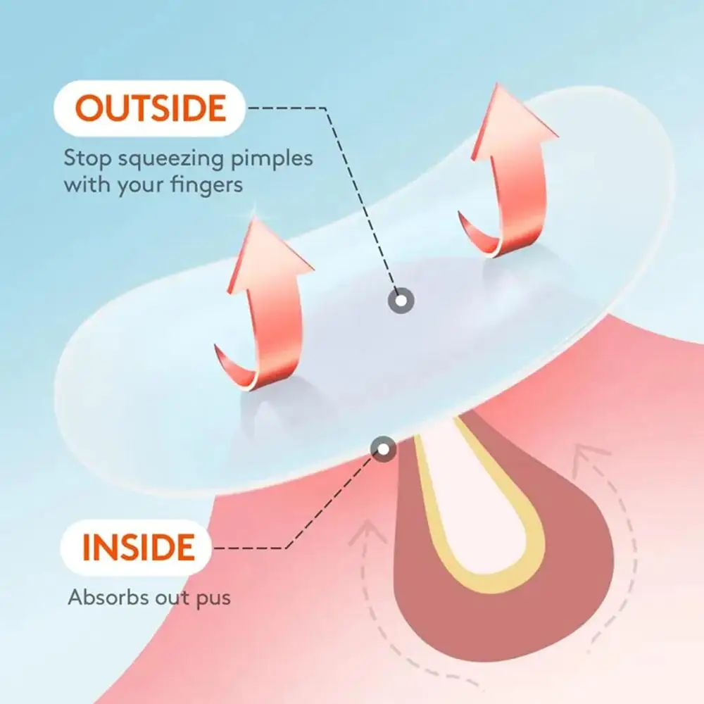 30/60/90 قطعة حب الشباب بثرة بقع هيبوالرجينيك غير مزعجة يهدئ الجلد غير مرئية رقيقة حمض الساليسيليك شجرة الشاي النفط حب الشباب الرعاية