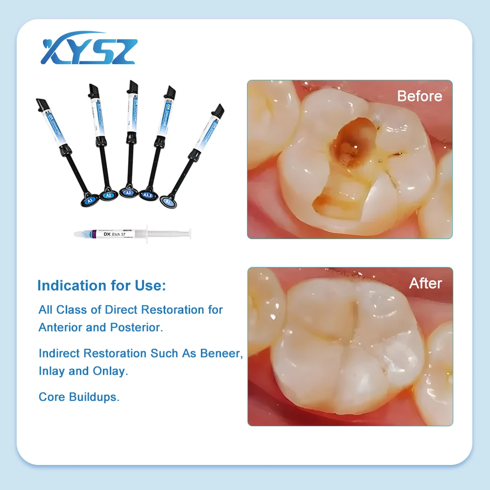 Universal Dental Cura Light Glue, resina composta, colagem adesiva, Etch Gel Kit, suporte ortodôntico, gel de dentes