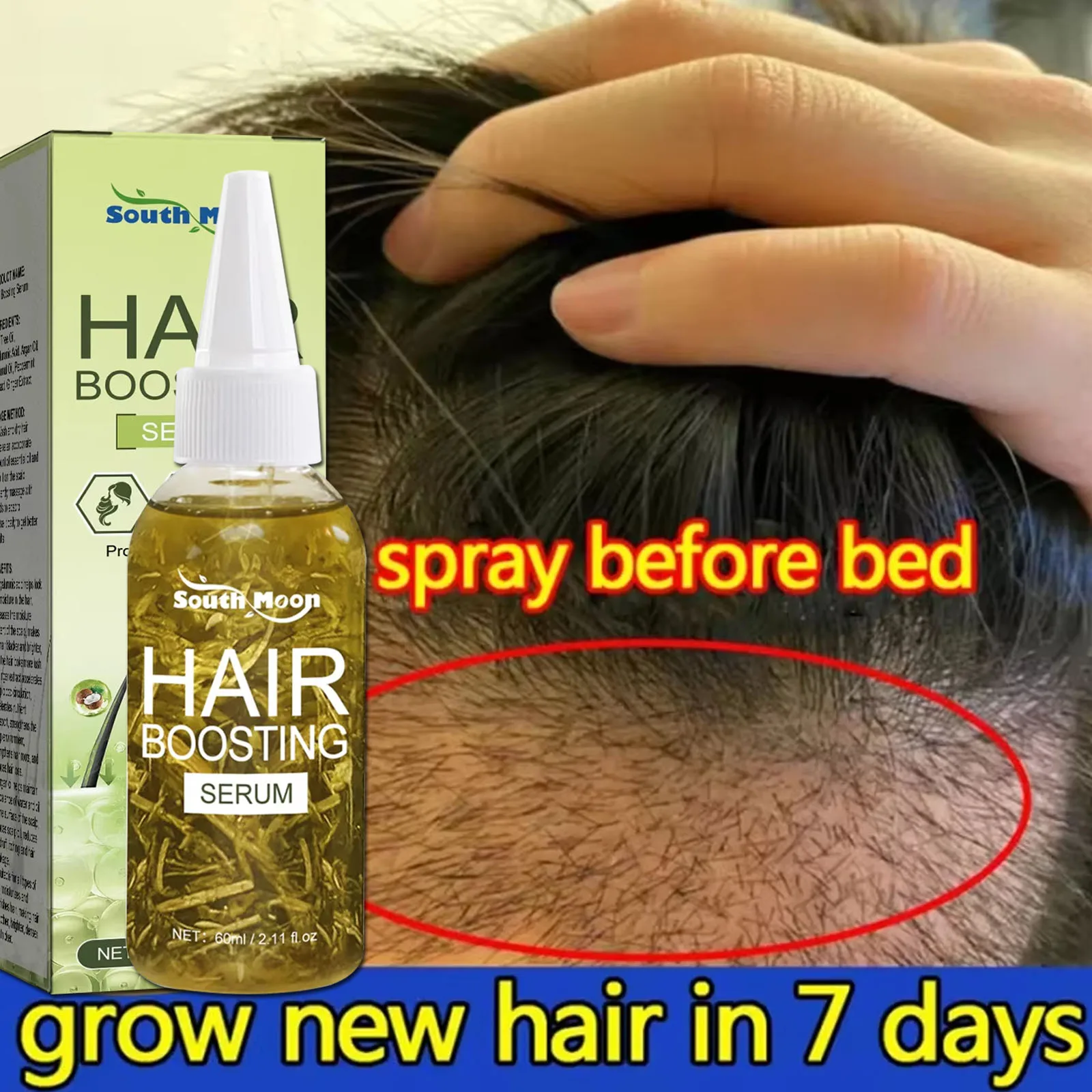زيت نمو الشعر السريع أفريقيا مجنون الجر الثعلبة مصل مكافحة كسر الشعر رشاقته علاج تساقط الشعر رذاذ للرجل المرأة 60 مللي #1