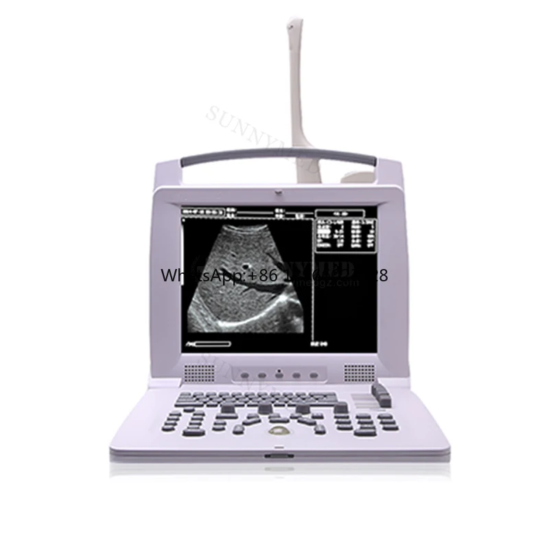 SY-A005 Free Carrying Vet Ultrasound Scanner big and Small Animals pig dog horse cattle sheep Pregnancy Ultrasound Scanner