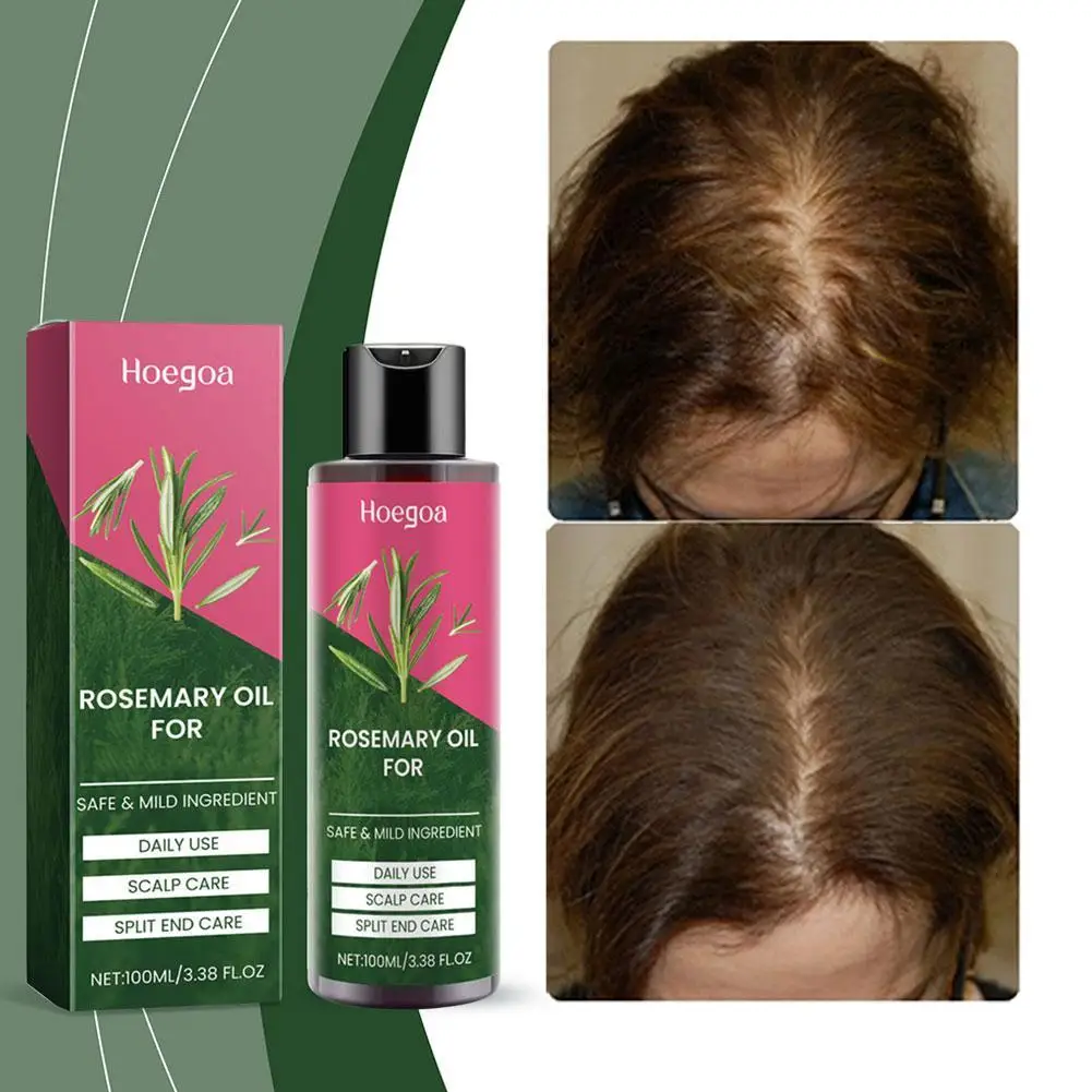 Produk minyak esensial Rosemary produk rambut organik minyak penguat rambut kulit kepala untuk memelihara rambut mengkilap sehat M6U6